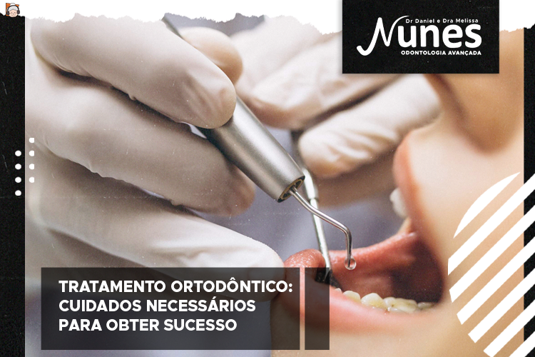 Tratamento ortodôntico: segredos – Nunes Odontologia – Belo Horizonte